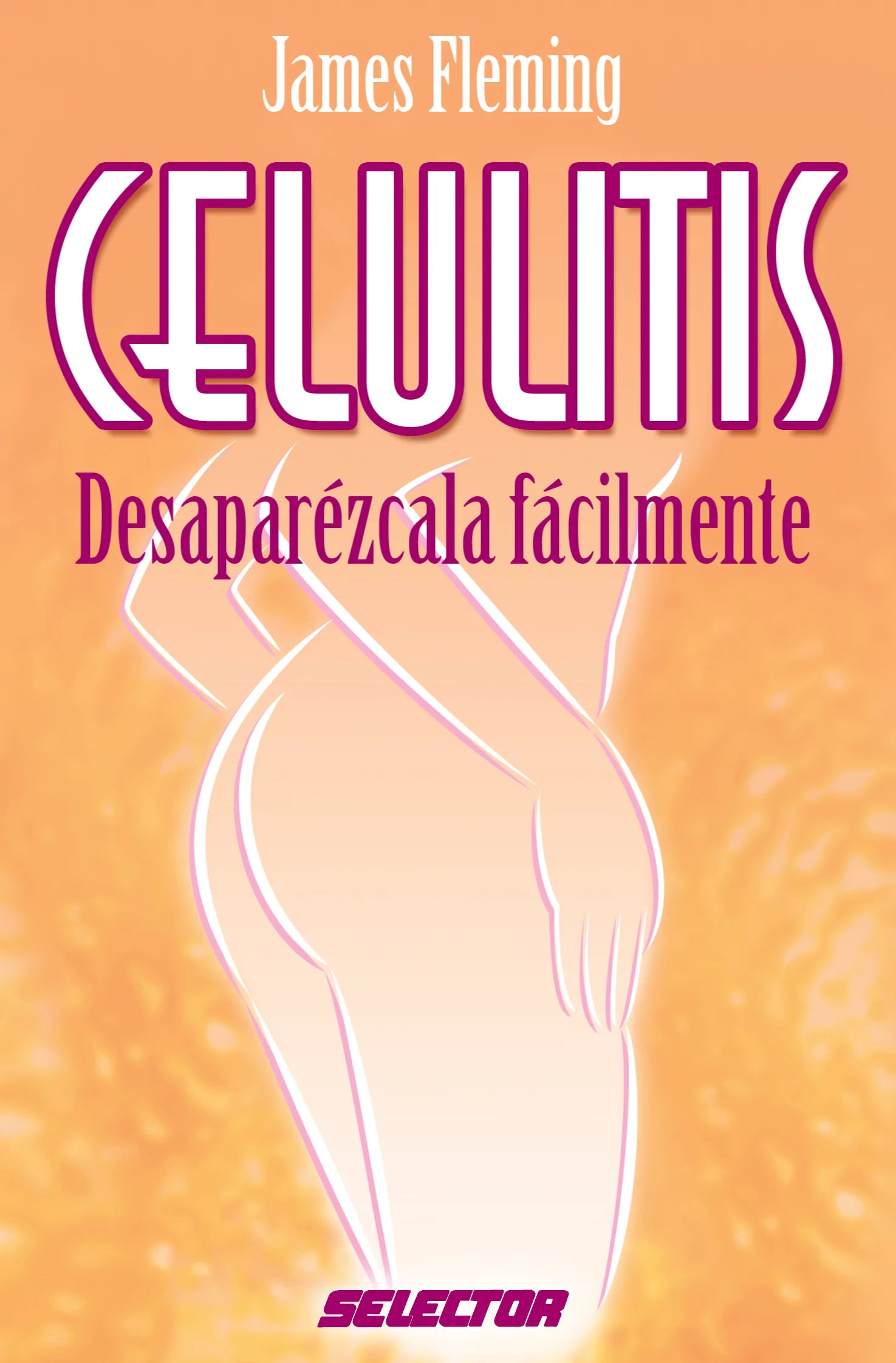 Celulitis - Editorial Selector